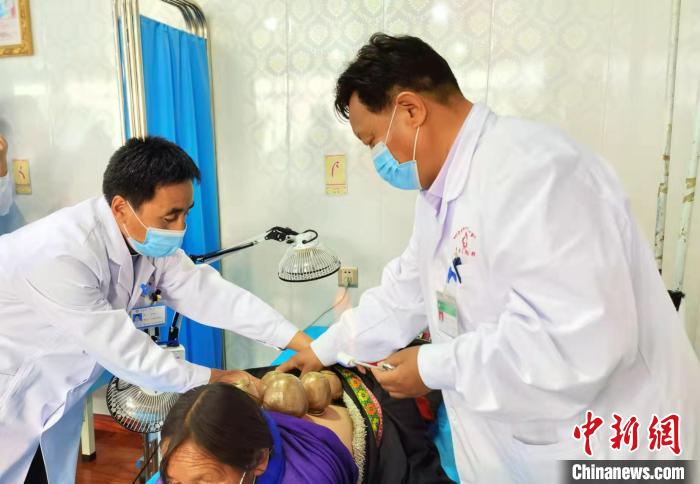 圖為看照加手把手帶徒弟加老(左一)進行拔罐療法?！堟?攝